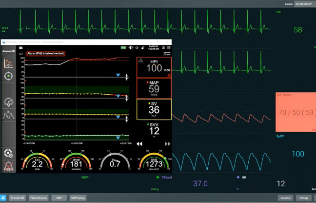 Acumen HPI case study